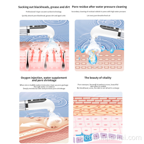 Blackhead Cleaner With Three-level Suction